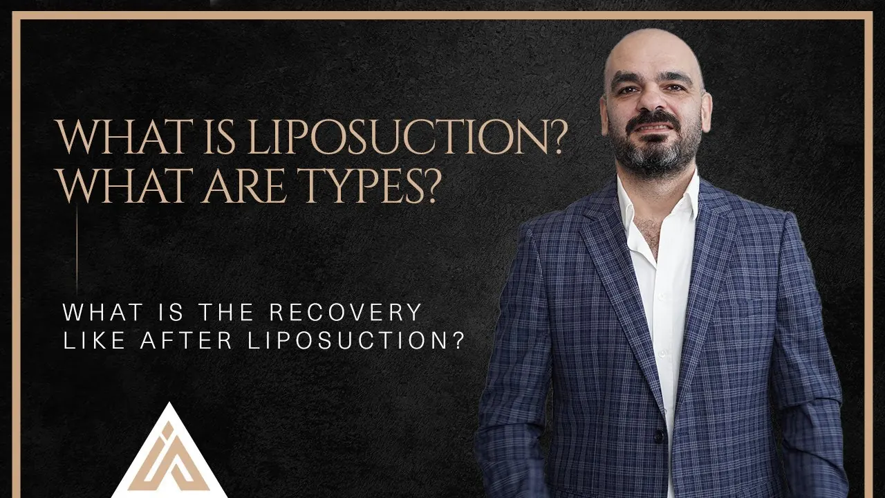 What is Liposuction?